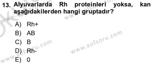 İş Hijyeni ve Ergonomi Dersi 2020 - 2021 Yılı Yaz Okulu Sınavı 13. Soru