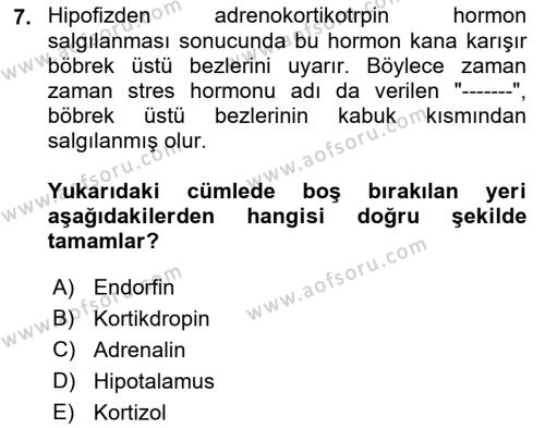 İş Yaşaminda Risk Etmenleri Ve Yönetimsel Faktörler Dersi 2022 - 2023 Yılı (Final) Dönem Sonu Sınavı 7. Soru