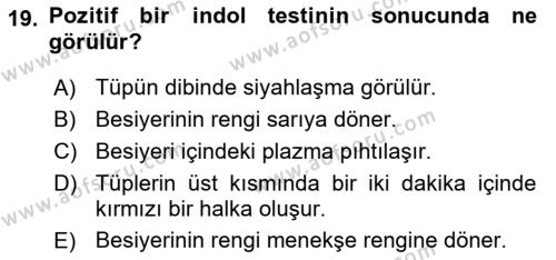 Temel Veteriner Mikrobiyoloji ve İmmünoloji Dersi 2021 - 2022 Yılı (Vize) Ara Sınavı 19. Soru