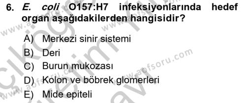 Gıda Güvenliğinin Temel Prensipleri Dersi 2018 - 2019 Yılı Yaz Okulu Sınavı 6. Soru